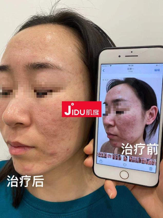 肌度:美容院銷售額從1000到10萬+,銷售大神教你賣貨