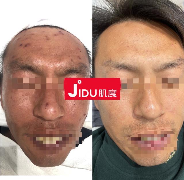肌度:美容院銷售額從1000到10萬+,銷售大神教你賣貨