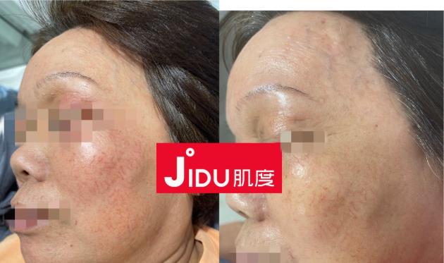 肌度:美容院銷售額從1000到10萬+,銷售大神教你賣貨