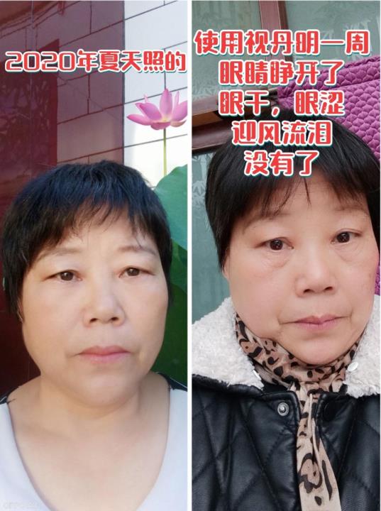 視丹明效果怎么樣,視丹明怎么代理的