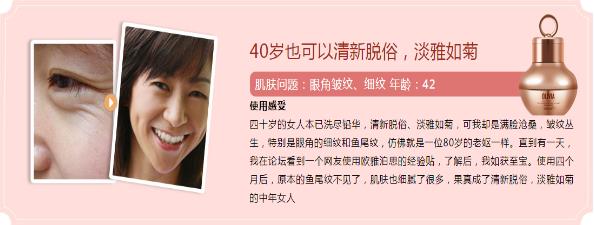 眼角細紋怎么辦?歐雅泊思教您如何快速去除眼部細紋!(瘋轉(zhuǎn))