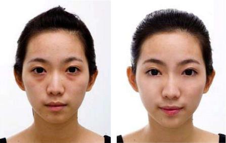 黑眼圈怎么樣消除?按摩+歐雅泊思助您快速消除“熊貓眼”!