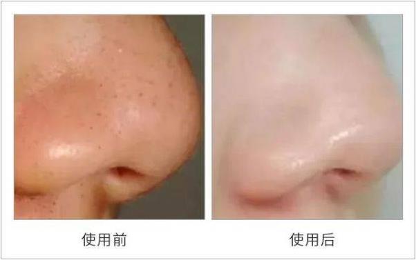 wro蛇床子洗面奶孕婦可以用嗎