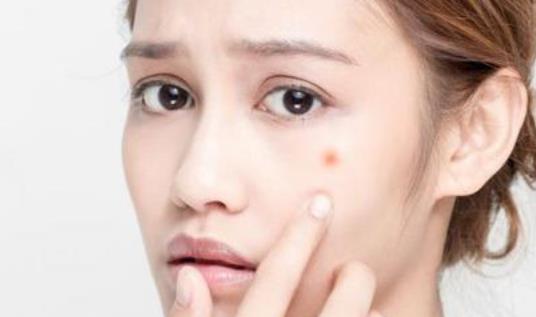 長(zhǎng)痘痘的人需要注意什么?長(zhǎng)痘痘的人日常護(hù)理