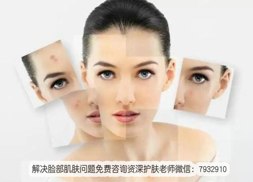 抗敏感肌護(hù)膚品有嗎?高度敏感肌膚怎么辦?
