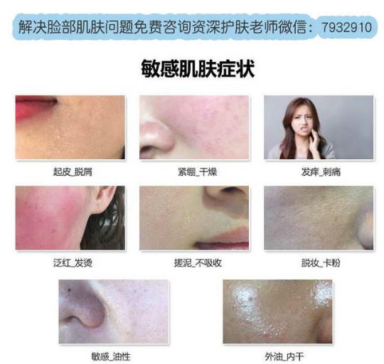 敏感肌膚用什么護(hù)膚品?敏感肌膚護(hù)理你只需要這樣做