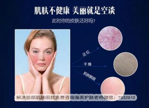 干性皮膚紅血絲怎么辦?朵嘉濃的護膚品真的能修復好皮膚嗎?
