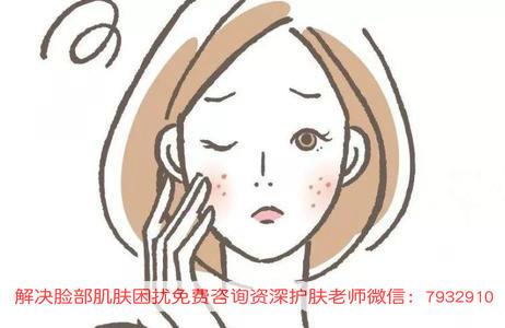 過敏臉上起痘痘怎么辦?有人用朵嘉濃修復好的嗎?