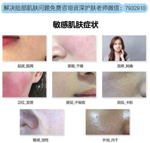 臉過敏癢怎么處理?秋冬季臉過敏你該這么做!