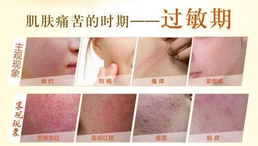 臉過敏癢怎么處理?秋冬季臉過敏你該這么做!