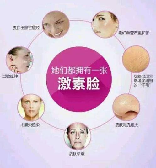 海英:激素臉是怎么形成的?激素臉怎么修復(fù)?激素臉的修復(fù)周期是多久?