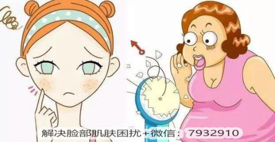 懷孕了臉過敏長痘痘怎么辦?孕期痘痘怎么安全祛除?