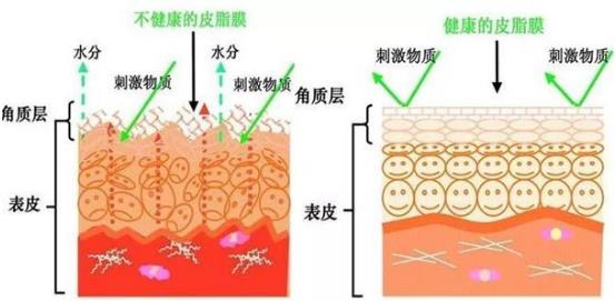 懷孕得了激素臉怎么辦?懷孕期間能用護(hù)膚品嗎?