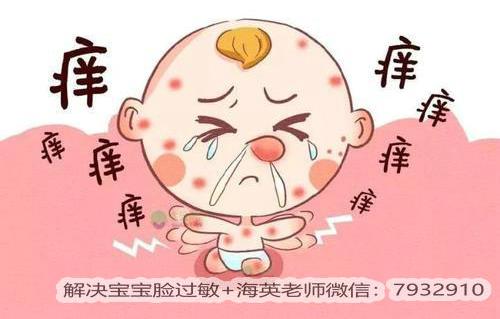 寶寶臉過敏可以用護(hù)膚品嗎?什么護(hù)膚品適合寶寶用?