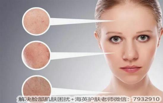 臉部皮膚過敏怎么辦?臉過敏的癥狀有哪些?