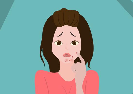 鼻子上長膿包痘多久會(huì)消?眉毛長痘痘怎么辦?