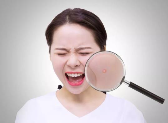 擠痘痘顱內(nèi)感染會死嗎?擠痘痘顱內(nèi)感染多久能看出來?