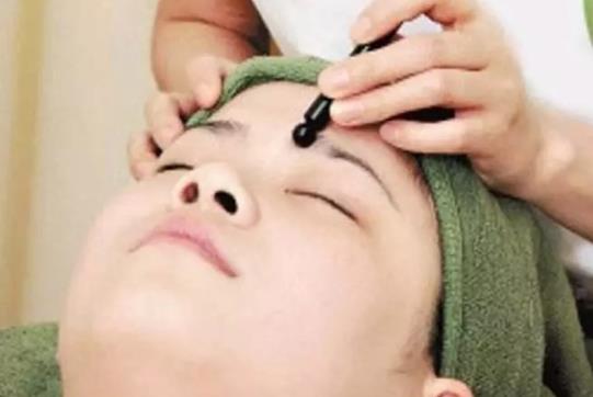 黑頭能用手?jǐn)D出來(lái)嗎?黑頭能徹底清除嗎?