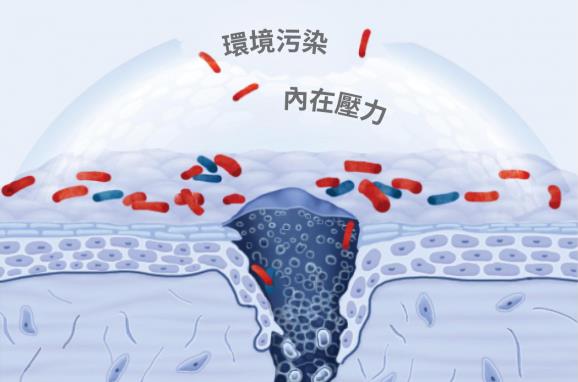皮膚問題反復(fù)?Cn刷菌科學(xué)修復(fù),掃除問題肌,刷新護膚新感受!