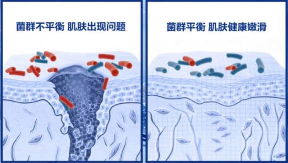 皮膚問題反復(fù)?Cn刷菌科學(xué)修復(fù),掃除問題肌,刷新護膚新感受!
