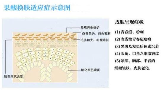 廣州伊站皮膚管理 :夏天如何有效控油