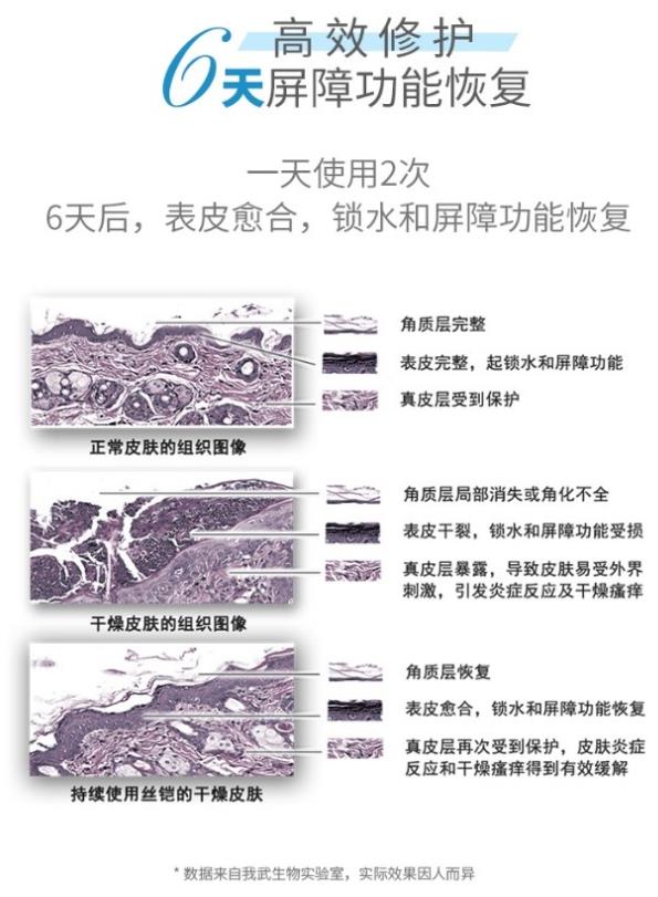 絲鎧絲素蛋白保濕霜,拯救秋冬季干燥瘙癢的皮膚!