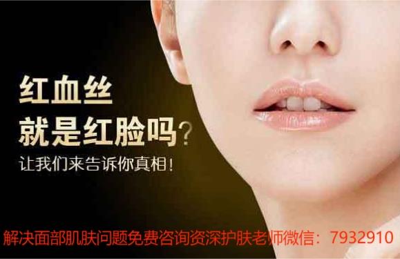 面部有紅血絲會怎樣?用朵嘉濃護膚品能解決嗎?