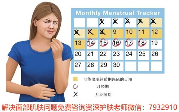 朵嘉濃祛痘凝膠快速祛痘,祛痘新方法真不賴