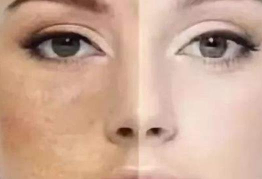 女性們總是奇怪自己的肌膚暗黃 女性皮膚暗黃五大生活因素