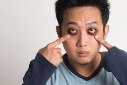 男性要護膚 多照顧眼部肌膚