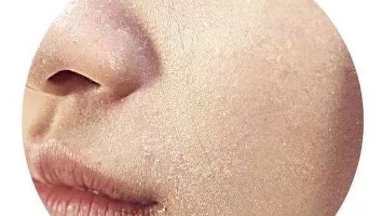肌膚的敏感常常會(huì)困擾愛美的美女們 敏感皮膚的九點(diǎn)護(hù)膚原則