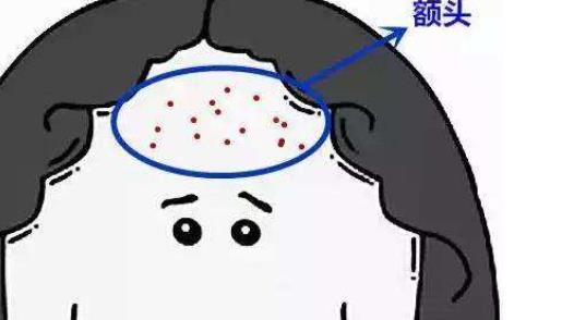 女性天性愛美容不得臉上存在瑕疵 生活中10大影響面相的肌膚問題