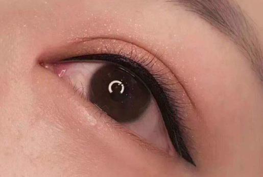 秋季容易忽視的九個皮膚小毛病 皮膚問題層出不窮
