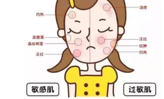 敏感性皮膚怎么保養(yǎng) 敏感性皮膚的3大特點