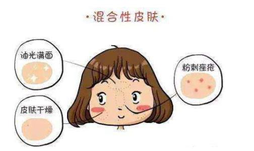 混合性皮膚用什么卸妝乳 混合性皮膚護理的3大要素