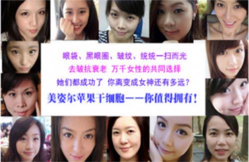 眼下有眼袋怎么消除 讓你告別腫泡眼的方法