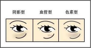 黎京雄院長提醒你:別以為黑眼圈只是熬夜的錯