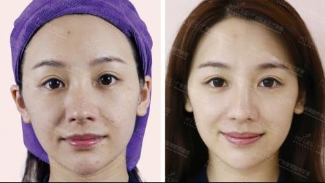 央視大劇《破冰行動》今首播 女演員黃菲“美膚功臣”就是廣州美萊!