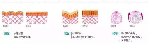 香蜜麗格【笑是原罪?】20歲就有法令紋了?難道是我老了嗎?