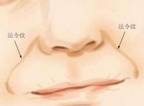香蜜麗格【笑是原罪?】20歲就有法令紋了?難道是我老了嗎?
