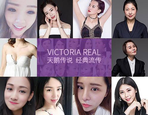 張家口維多利亞美容怎么樣 國慶整形優(yōu)惠活動來襲