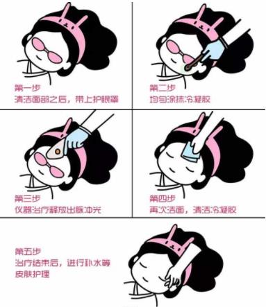 重慶瑪恩皮膚怎么樣 揭秘光子嫩膚治療全過(guò)程