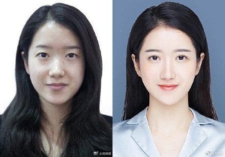 29城女子公布整容前后證件照,改變的不只是容貌更是命運(yùn)