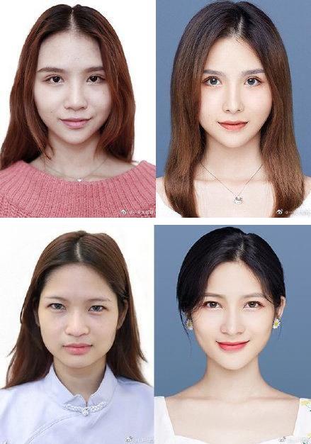 29城女子公布整容前后證件照,改變的不只是容貌更是命運(yùn)