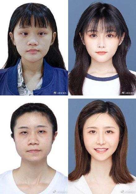 29城女子公布整容前后證件照,改變的不只是容貌更是命運(yùn)