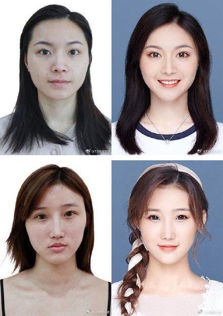 29城女子公布整容前后證件照,改變的不只是容貌更是命運(yùn)