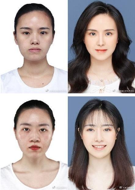 29城女子公布整容前后證件照,改變的不只是容貌更是命運(yùn)