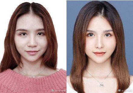 29城女子公布整容前后證件照,改變的不只是容貌更是命運(yùn)