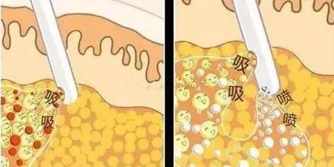 美貝爾整形醫(yī)院正規(guī)嗎 愛(ài)心醫(yī)院公益為民