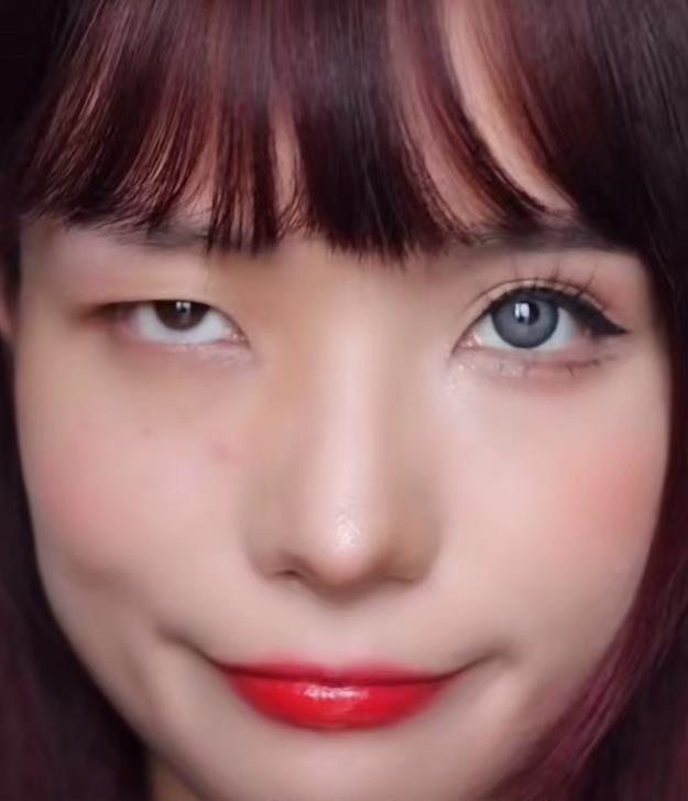 【寧波卓美】雙眼皮是一個(gè)小手術(shù)嗎?失誤真的很小嗎?